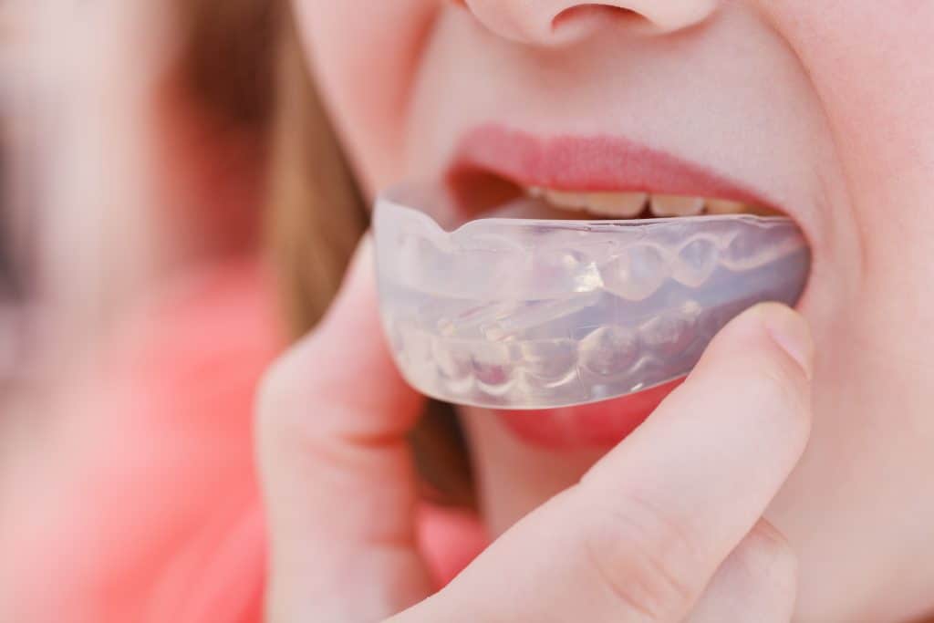 patient wearing a dental mouthguard