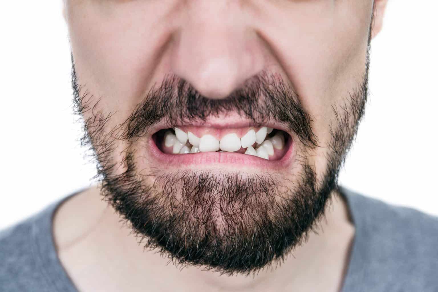 patient with crooked teeth