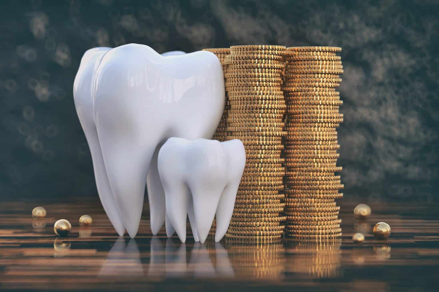 Value Teeth The Costs To Get Your Teeth White - Vineyard Dental Sunbury
