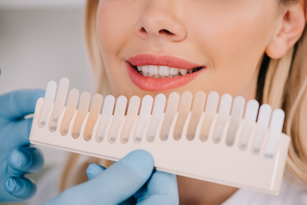 Close up photo of a girl showing her white teeth against the shade scale