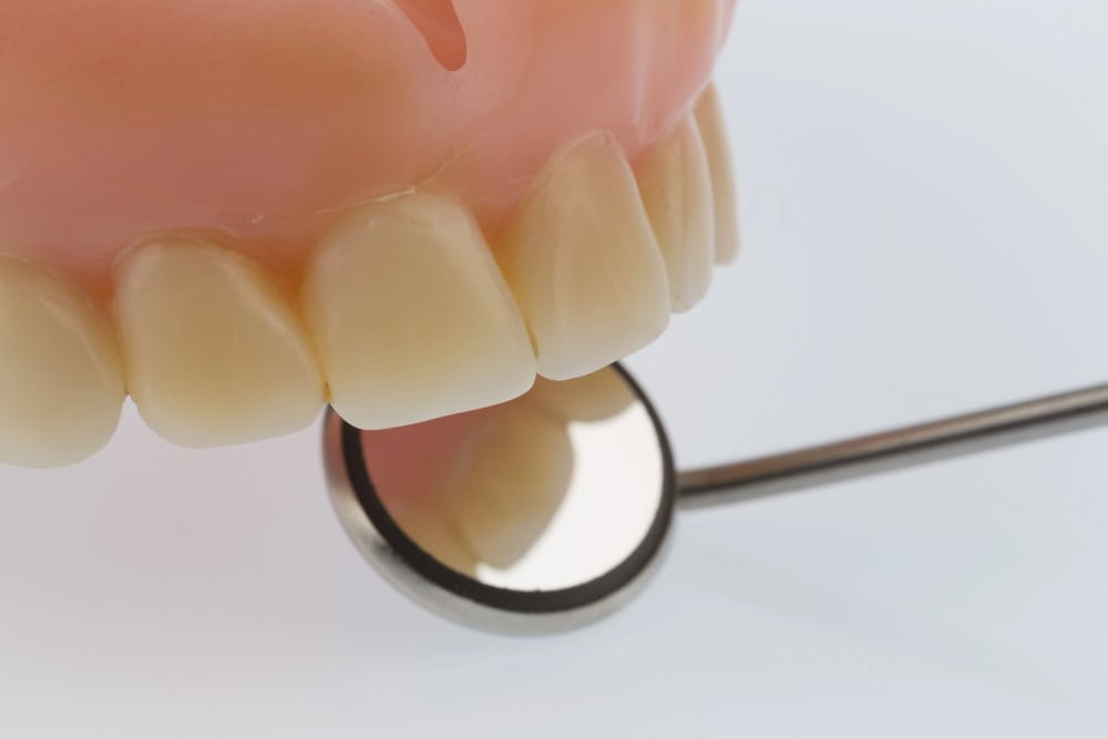how can you tell if a tooth implant is failing