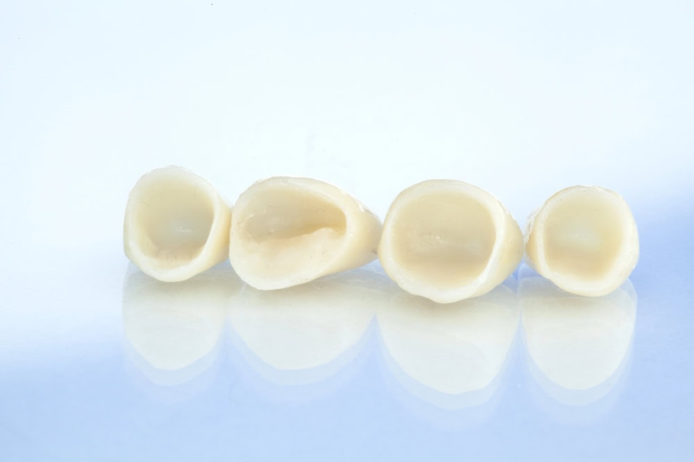 Dental Crowns in Sunbury