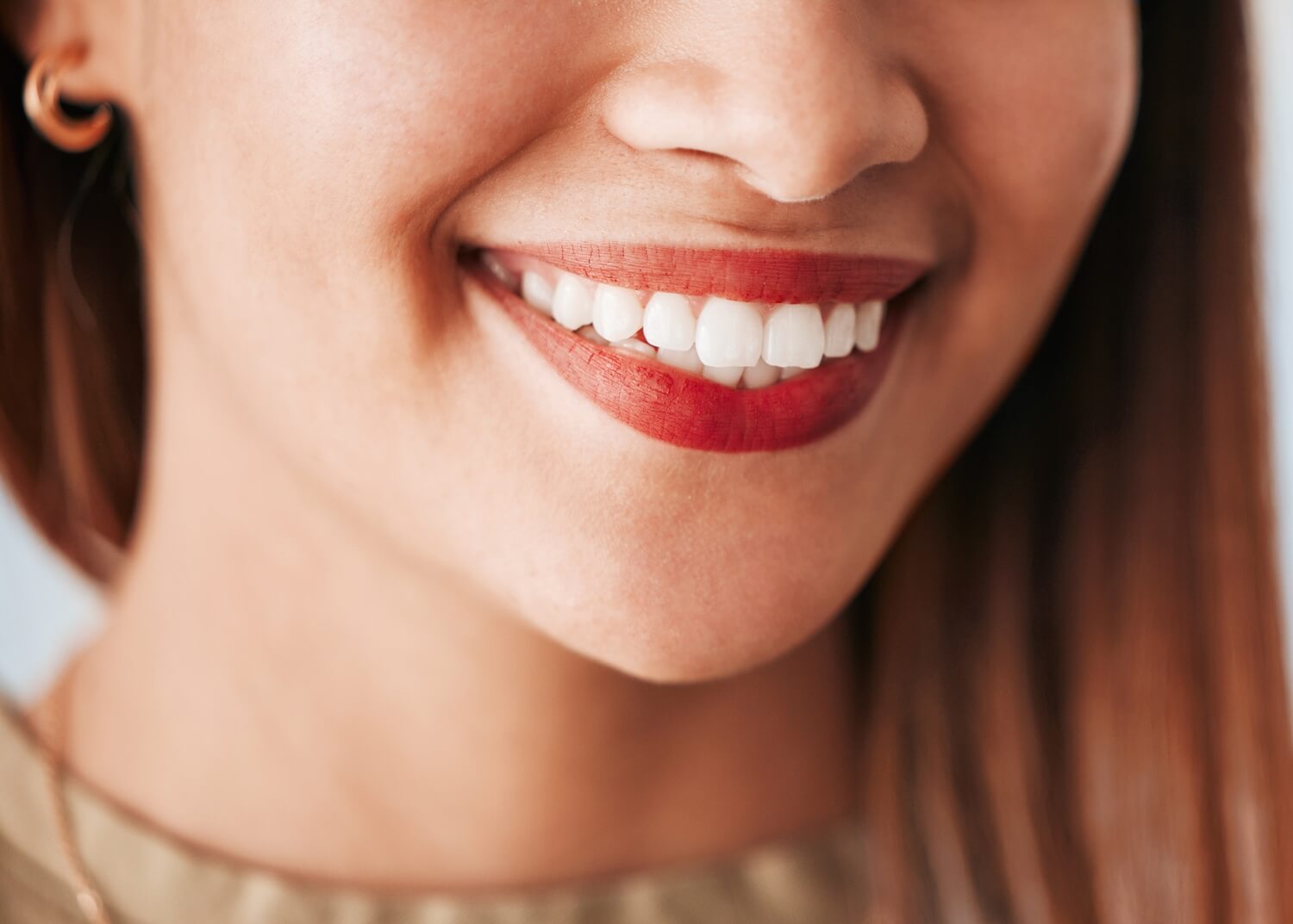 woman smiling with veneers