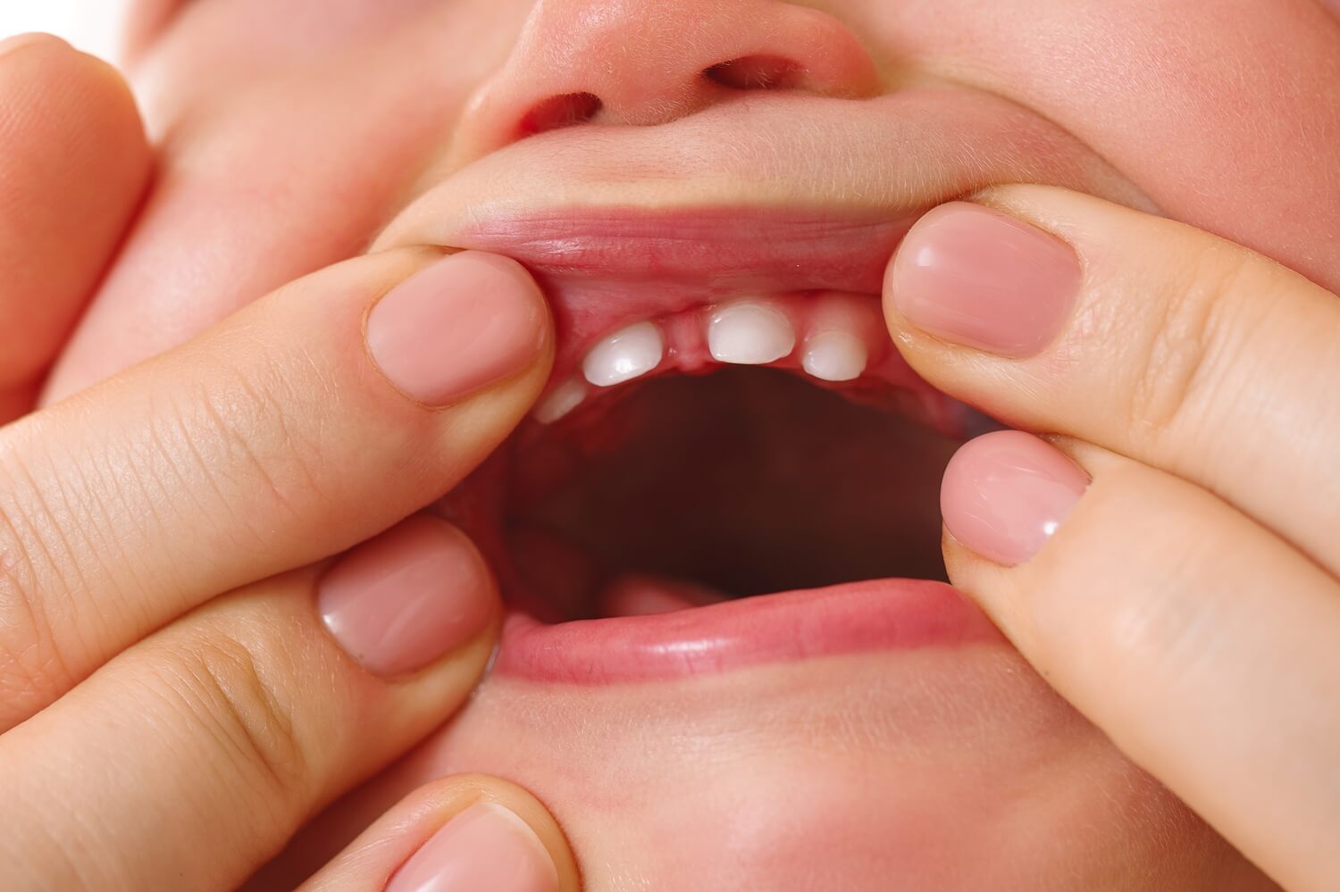 a baby showing baby teeth