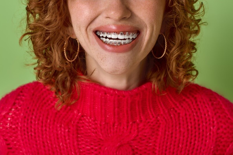 adult woman smiling with braces in ret sweatshirt