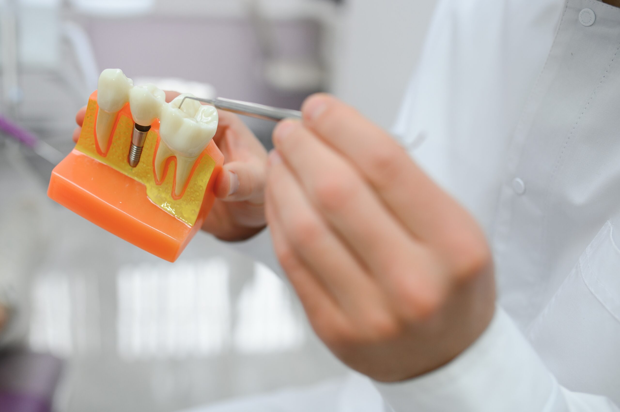 Dentist using a dental model to show a dental implant post and crown between natural teeth, explaining dental implant recovery